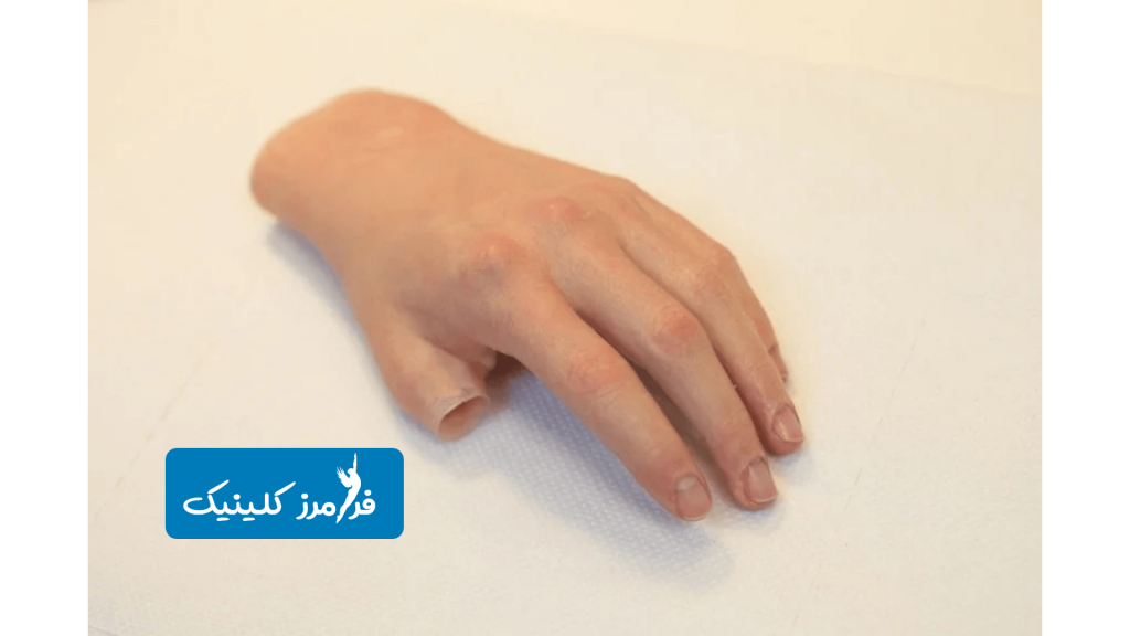 پروتزهای زیبایی