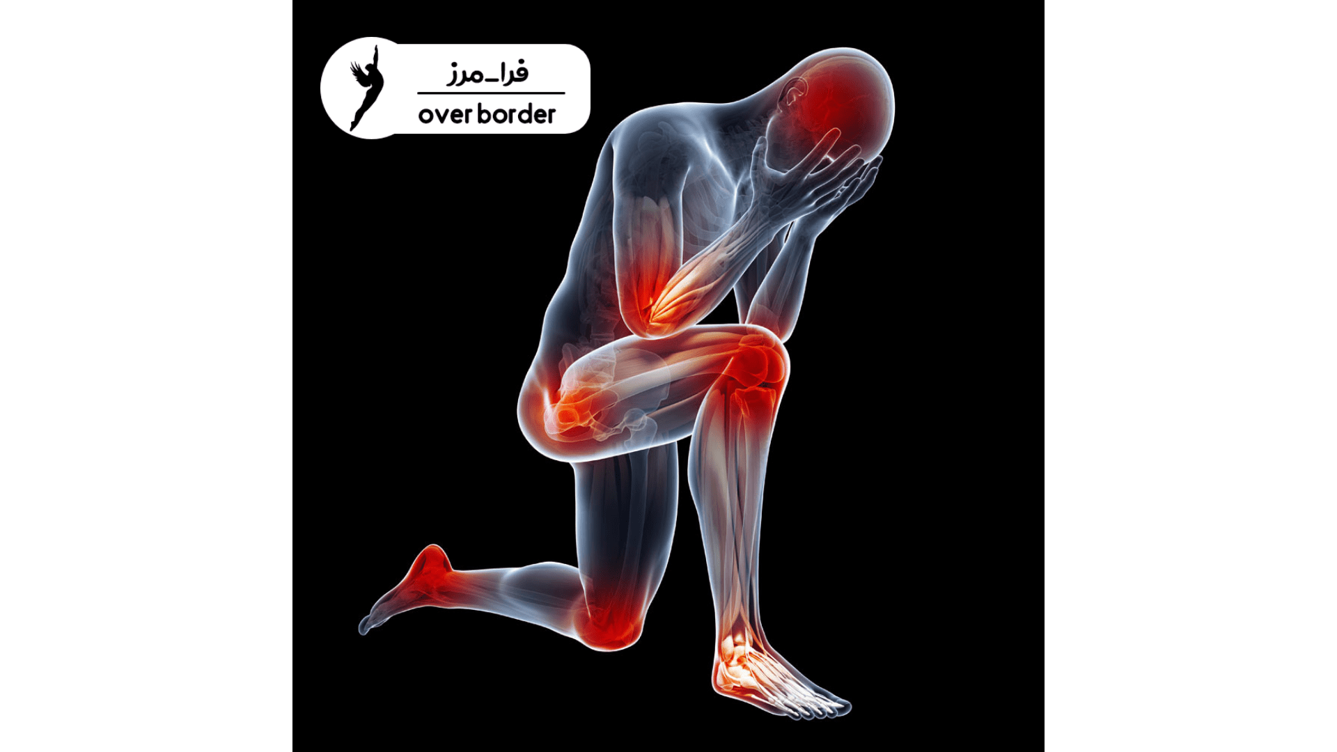 مشکلات مفصلی بعد ار کرونا