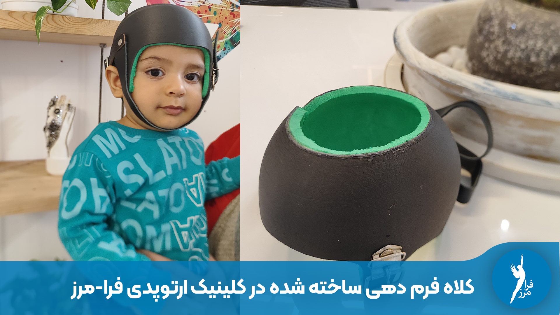 قیمت کلاه فرم دهی سر نوزاد