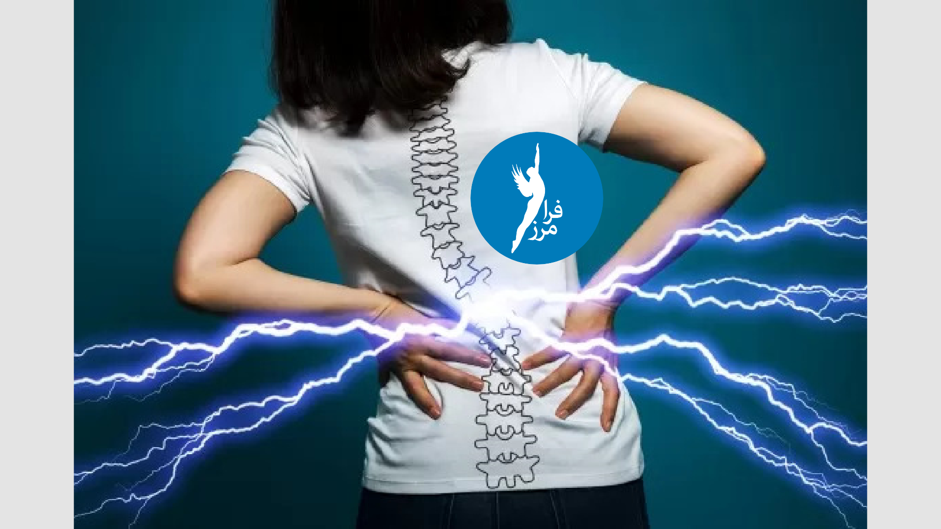 کمردرد (LBP) یا اپیدمیولوژی چیست؟