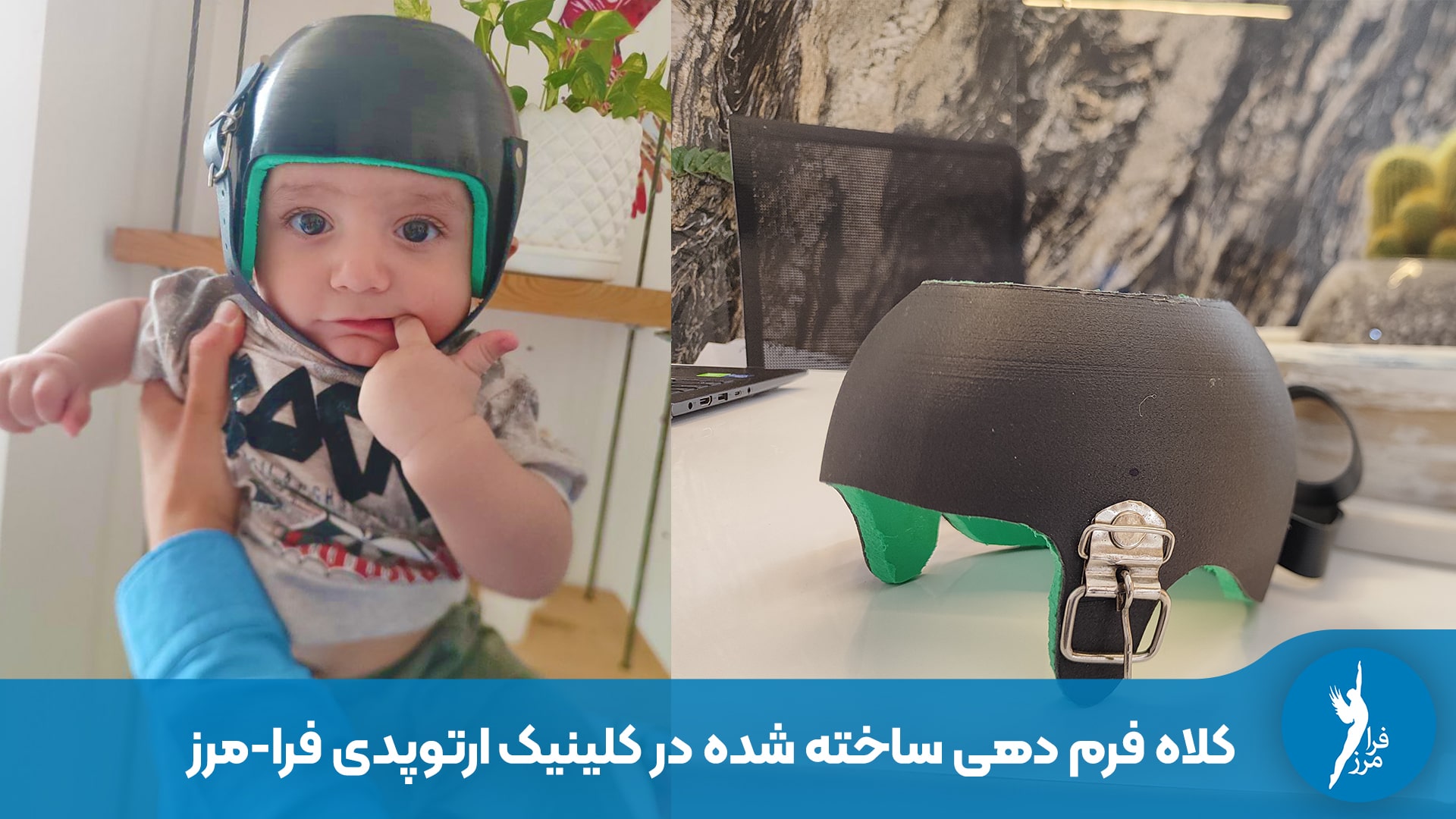 قیمت کلاه طبی سر نوزاد