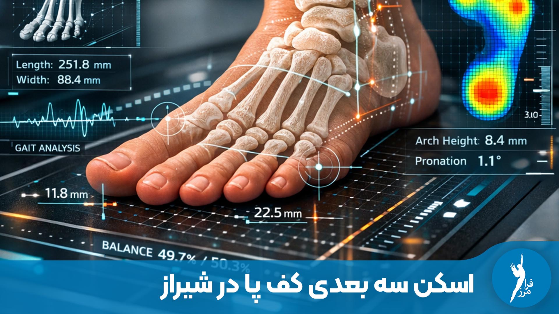 اسکن کف پا در شیراز برای بررسی فشار پا، خار پاشنه، کف پای صاف و ساخت کفی طبی اختصاصی در کلینیک ارتوپدی فنی فرا-مرز.