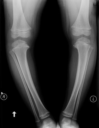 همه چیز راجب پای پرانتزی در مطلب ما