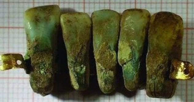 پروتز دندان در باستان