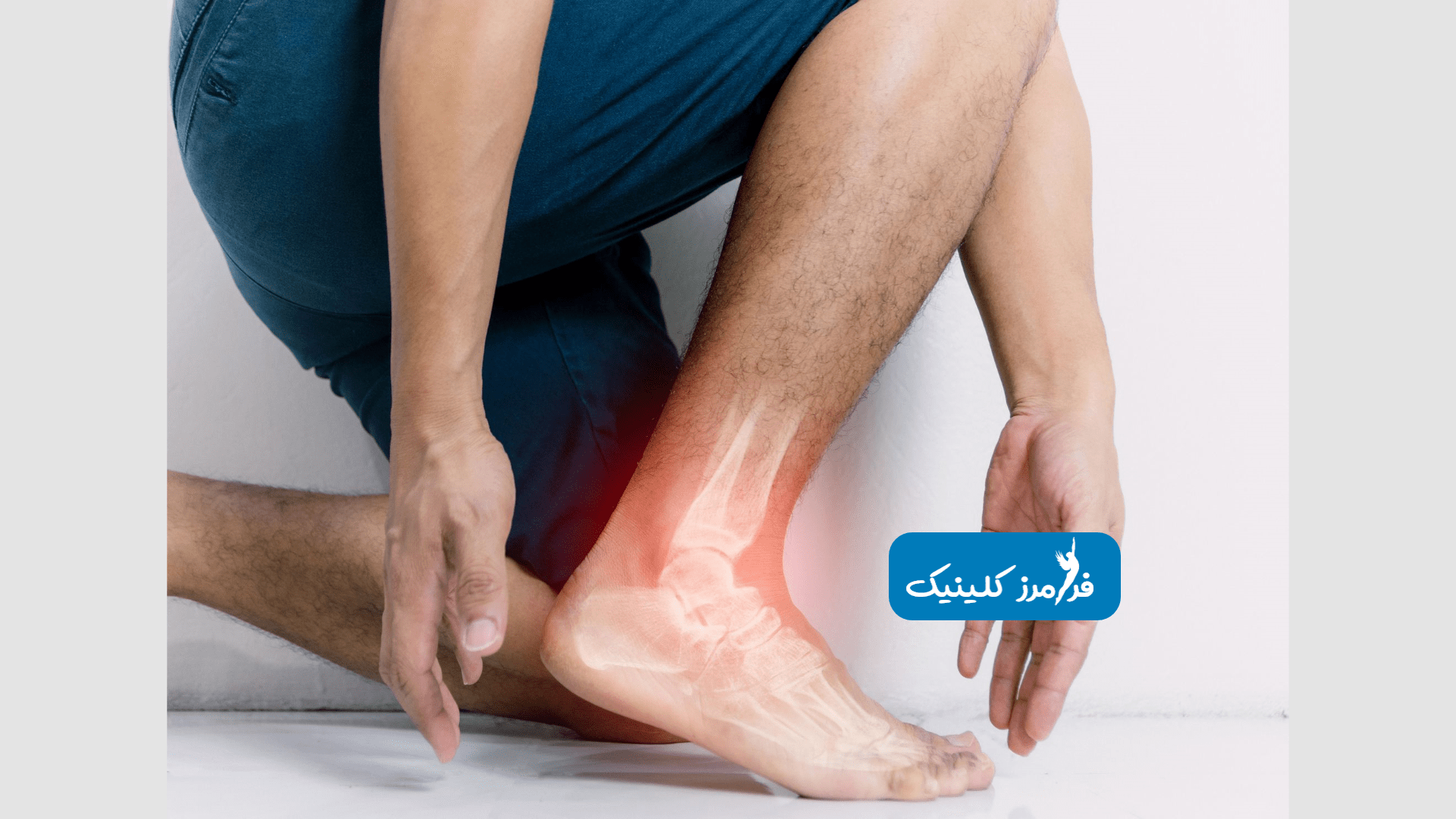 بیماری هایی که ممکن است برای پاهای شما ایجاد شود