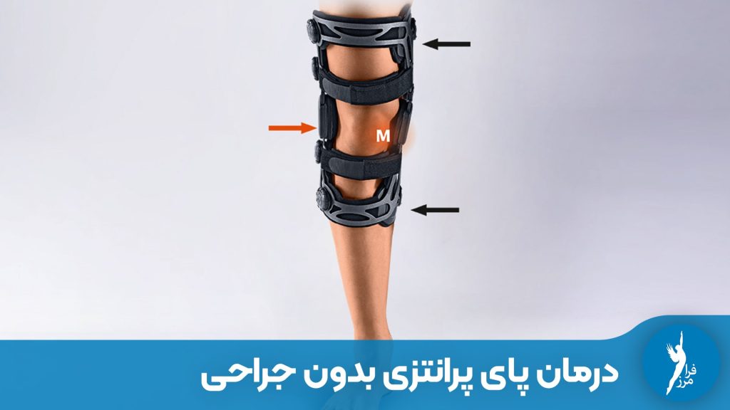 درمان پای پرانتزی بدون جراحی