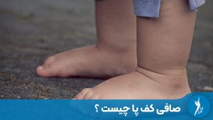 صافی کف پا چیست؟