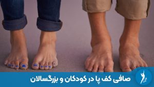 صافی کف پا در کودکان و بزرگسالان