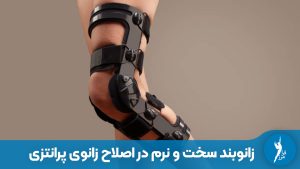 زانوبند سخت و نرم در اصلاح زانوی پرانتزی