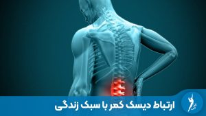 ارتباط دیسک کمر با سبک زندگی؛ بررسی دیدگاه علمی