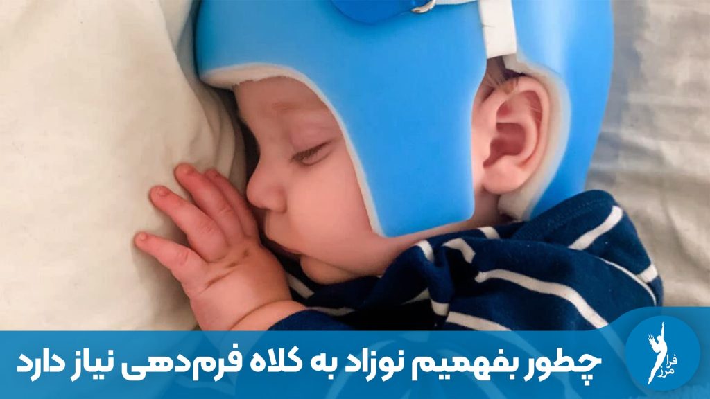 چطور بفهمیم نوزاد به کلاه فرم‌دهی نیاز دارد