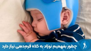 چطور بفهمیم نوزاد به کلاه فرم‌دهی نیاز دارد