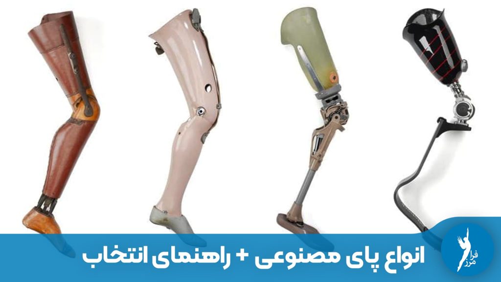 انواع پای مصنوعی چیست؟ بررسی کامل تفاوت پروتزهای سیلیکونی (زیبایی)، مکانیکی، کربنی و هوشمند. راهنمای انتخاب بهترین پای مصنوعی بر اساس قیمت و کاربرد در کلینیک فرامرز.