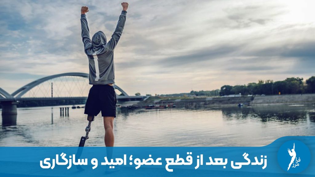زندگی بعد از قطع عضو چگونه است؟ روایتی از چالش‌های روانی، درد فانتوم و مراحل سازگاری با پای مصنوعی. مقاله‌ای امیدبخش برای بازگشت به زندگی مستقل در کلینیک فرامرز.