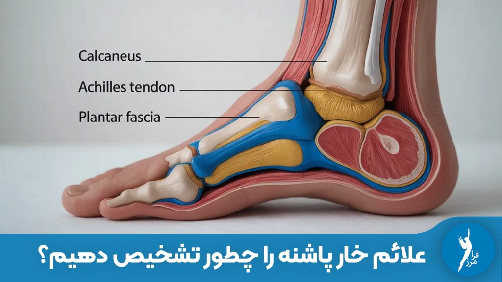 Meta Description: علائم خار پاشنه چیست؟ تشخیص درد صبحگاهی پاشنه، درد بعد از استراحت و تفاوت آن با سایر دردهای پا. راهنمای کامل تشخیص بالینی و خانگی در سایت کلینیک فرامرز.
