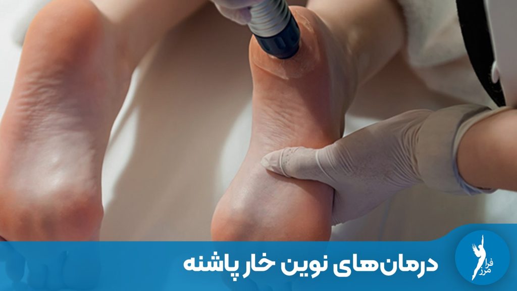 درمان‌های نوین خار پاشنه