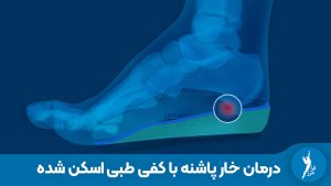 چرا پدهای ژله‌ای خار پاشنه را درمان نمی‌کنند؟ بررسی تخصصی تفاوت کفی طبی اختصاصی (CNC) با کفی‌های آماده. درمان قطعی درد پاشنه و التهاب فاشیا با اصلاح قوس پا در کلینیک فرامرز.