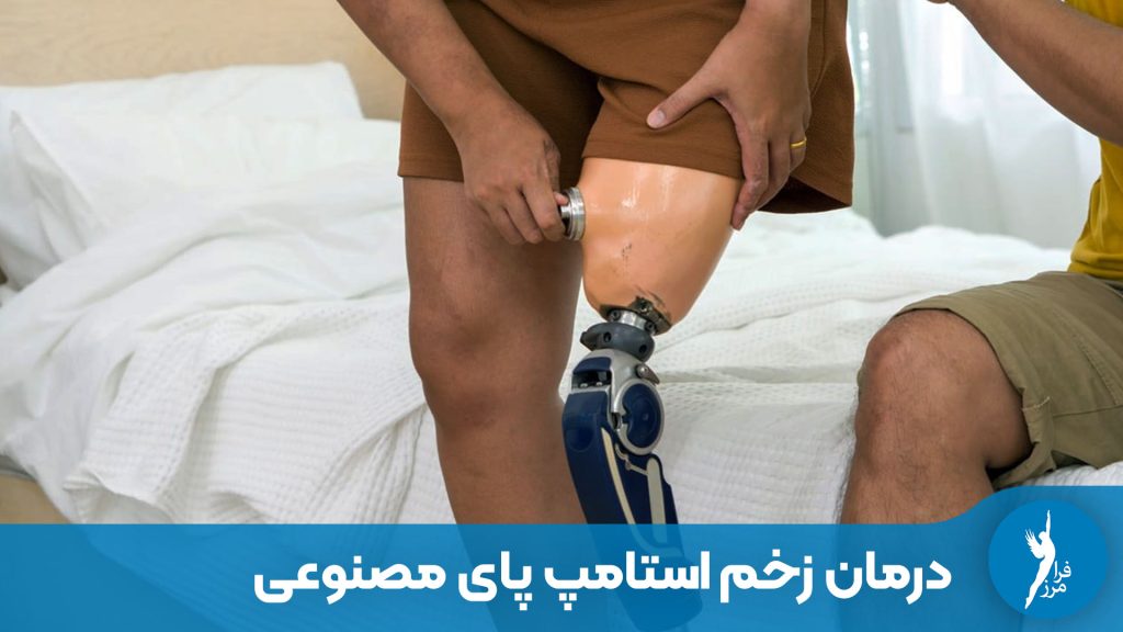 درمان زخم استامپ پای مصنوعی
