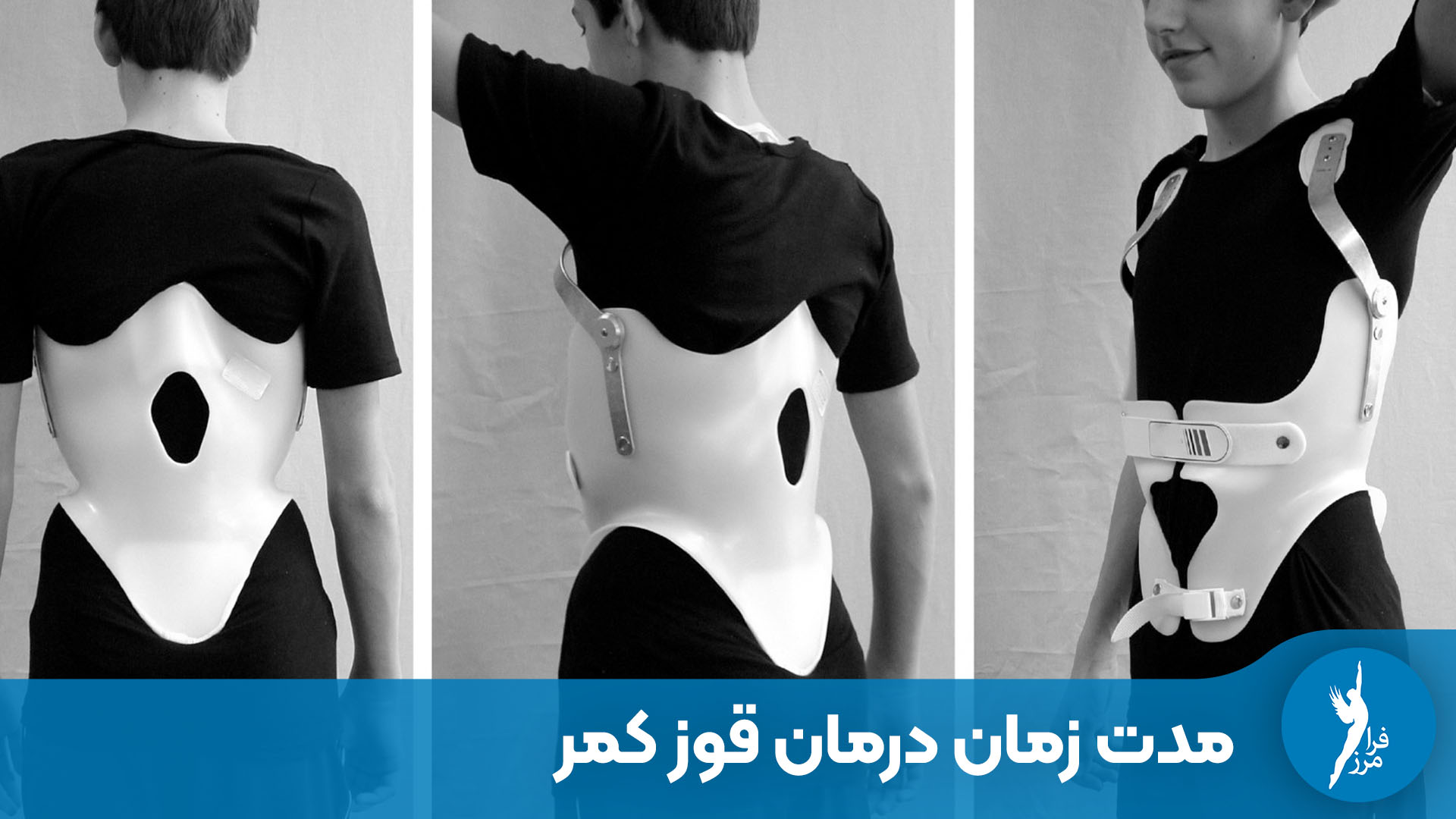 اصلاح قوز کمر (کایفوز) با بریس چند ماه زمان میبرد؟ بررسی تفاوت درمان در نوجوانان و بزرگسالان، معرفی مراحل سه گانه درمان و تأثیر نوع بریس بر سرعت بهبود.