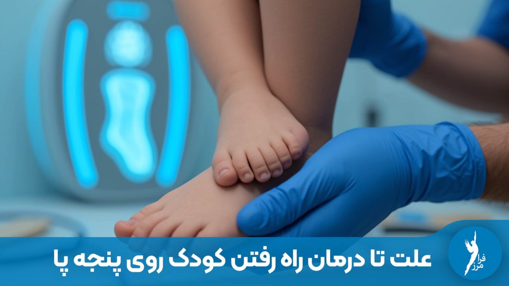 در این مقاله دلایل پنجه‌روی (از عادت تا کوتاهی تاندون آشیل) و بهترین روش‌های درمان غیرجراحی مانند کفی طبی و حرکات اصلاحی را بررسی کرده‌ایم.