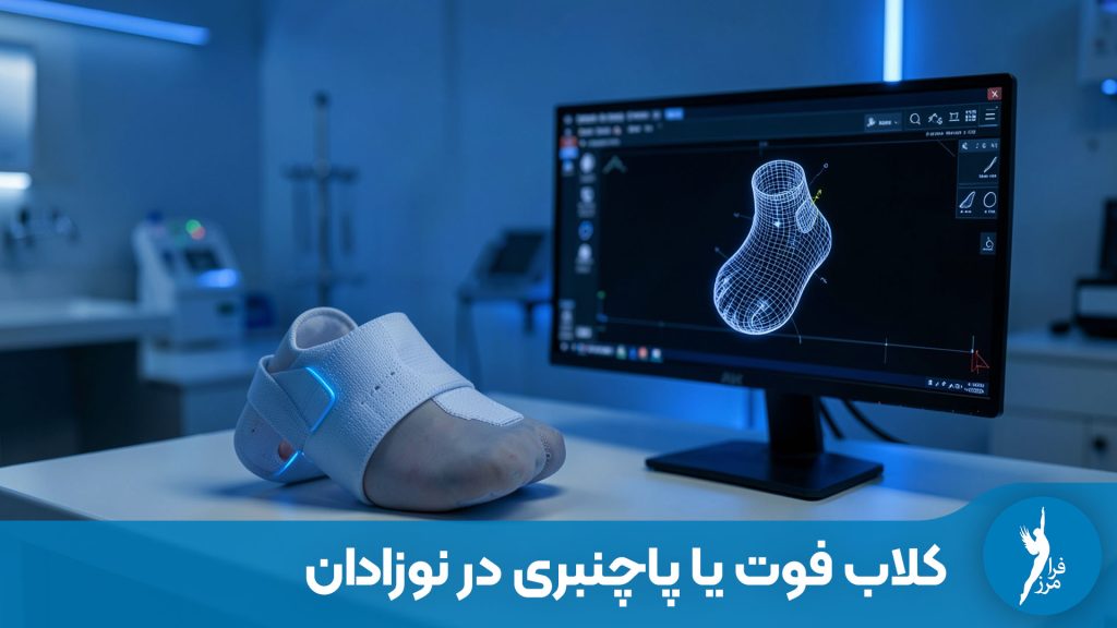 کلاب فوت یا پاچنبری چیست؟ راهنمای جامع درمان بدون جراحی با روش پونستی. ساخت بریس‌های اختصاصی کلاب فوت در کلینیک ارتوپدی فنی فرامرز.