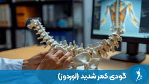 مدل آناتومیک ستون فقرات و بررسی گودی کمر شدید روی میز کلینیک ارتوپدی فنی